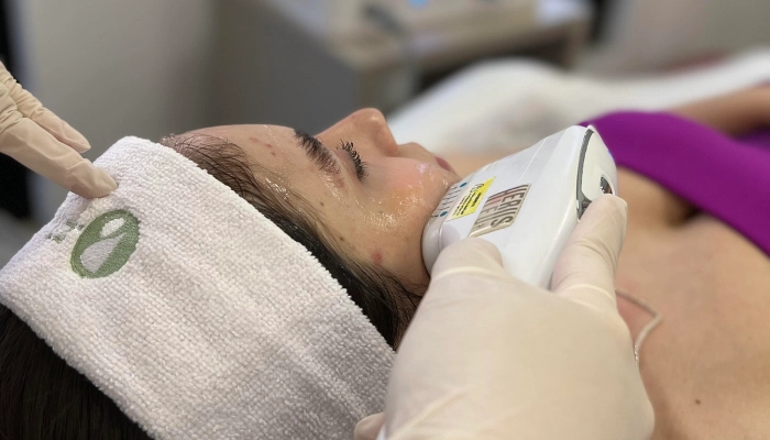 Ultrassom Microfocado Facial